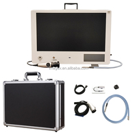 Système de caméra endoscopique intégré 3 en 1, caméra, lumière et moniteur combinés pour la laparoscopie