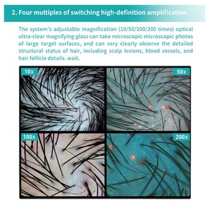 Nouvel analyseur de cuir chevelu 3-en-1, trichoscope alimenté par l'IA avec 8 spectres, 36MP de caméras, test d'humidité et détection des plis capillaires - Product Image 3