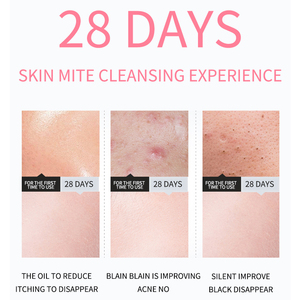 Marca privada <span class=keywords><strong>coreana</strong></span>, la mejor rosa Natural, orgánica, limpia y clara el acné, vegana, blanqueador, limpiador Facial espumoso - Product Image 4