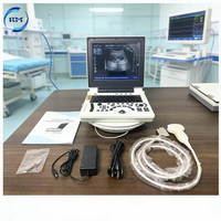 Appareil d'échographie portable numérique noir et blanc multifonctionnel pour le diagnostic en milieu hospitalier/clinique