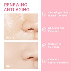 Crema Facial Halal Cosmética Rosa con AHA, Blanqueadora, Hidratante, para el Acné y las Imperfecciones, Vegetariana, Natural, Orgánica, con Extracto de Sandía - Product Image 3