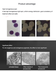 Los Instrumentos Más Populares en el Mercado de Belleza para la Eliminación de Problemas de Pigmentación de la Piel, Ideales para Hospitales y Salones de Belleza - Product Image 5