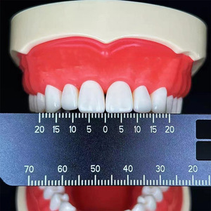 Regla de Medición Vertical Graduada de Doble Cara para Técnico Dental, Instrumento para Espaciado de Dientes, Instrumento de Raíz, Instrumentos Quirúrgicos Dentales - Product Image 3