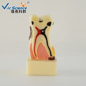 Modelo de Dentes Humanos em Quatro Vezes para Doenças Periodontais, Modelo Educacional em Ciências Médicas - Product Image 2