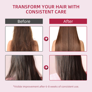 Dưỡng ẩm tự nhiên màu đỏ hành tây dầu gội đầu cho sự tăng trưởng tóc tăng cường và ngăn ngừa vỡ chăm sóc tóc - Product Image 6