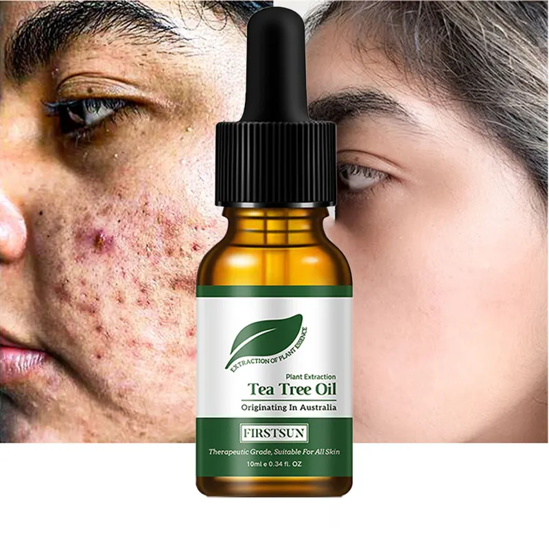 Commercio All'ingrosso di massa per La Cura Della Pelle 100% Olio di Tea Tree Puro Essenziale per Lo Sbiancamento Della Pelle il Controllo del Petrolio Idratante Acne Trattamento