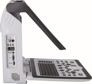 Ecógrafo Veterinario SIUI Apogee 2100, Ecógrafo Doppler Color Portátil de la Mejor Calidad para Escaneo de Animales Pequeños - Product Image 4