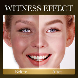 มาสก์กรดไฮยาลูโรนิกเกาหลีใต้แผ่นผ้าฝ้ายมาส์กหน้ามีคอลลาเจนให้ความชุ่มชื้นกับใบหน้า - Product Image 4