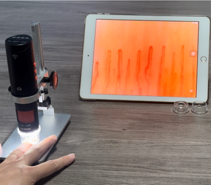 高倍率本物の400X血流モニタリング装置キャピラリー顕微鏡はAndroid iPhone iPadで動作します - Product Image 1