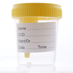 Gobelet de prélèvement d'urine 60 ml avec bouchon à vis en polypropylène, gobelet d'échantillon jetable pour usage médical - Product Image 4