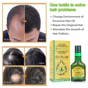 Produits de croissance capillaire stimulant, pour hommes et femmes, prévention de la chute des cheveux et de la calvitie, type spray
