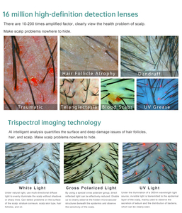 Detector de Folículos Capilares Portátil con Tecnología RGB UV PL de Triple Espectro, Analizador de Cuero Cabelludo Inteligente con IA - Product Image 2