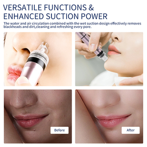 Dispositivo per la Rimozione dei Punti Neri con Iniezione di Ossigeno, Pulizia del Viso e Cura dei Pori, Prodotto di Bellezza per Donne - Product Image 3