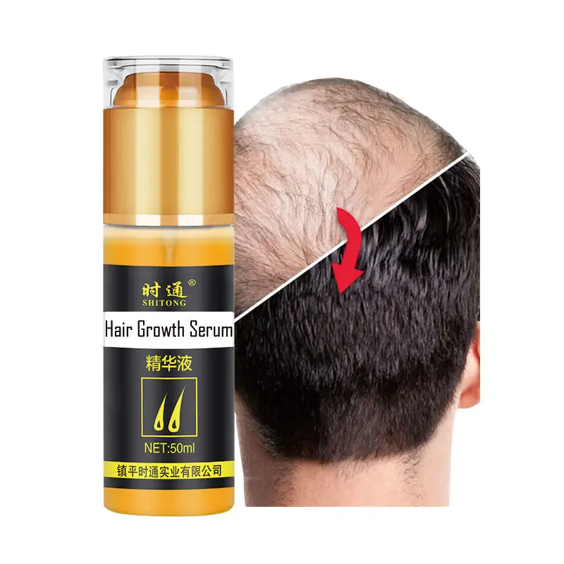Óleo essencial anti-perda de cabelo, arranjo de bhirngrai 6x15ml