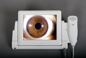 Analizador Portátil de Piel y Cabello con Pantalla LCD de 8 Pulgadas, Aumento de 50-200x, Operación Sencilla, Dermatoscopio con Video, Dispositivo de Belleza Chino - Product Image 3
