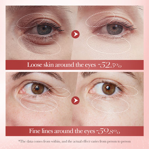 Crema Vegana de Ácido Hialurónico de Marca Blanca con Extracto de Caracol, <span class=keywords><strong>Antiojeras</strong></span>, Lifting, Reafirmante y Antiarrugas para Ojos Secos - Product Image 3