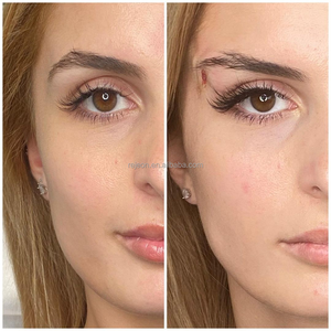 L REJEON 2-en-1 PDO Thread Lift Cog 4D L Blunt 21G 60mm Fox Eyes Logo Personnalisé Dispositif de Resserrement Cutané et de Lifting Facial pour Usage Clinique - Product Image 3