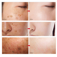 Échantillon gratuit de marque privée Crème hydratante profonde anti-visage pour la peau Hydratant