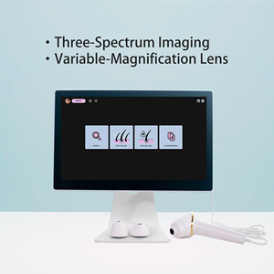 OEM AI 16MP 50X-200X Magnification 15.6inch Screen Hair Densitometer Hair Loss Detection Home Use Beauty Machine - Product Image 3