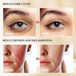 ช้อนน้ำแข็งสเตนเลส Cryo สำหรับดูแลผิวหน้า - Product Image 5