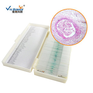 Typhoid fever, medical histology, digestive system diseases, animal and plant slides, <b>microscope</b> use. - Product Image 2