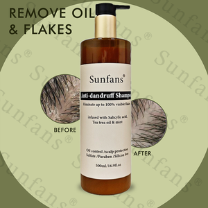 Shampoo antipelliculaire biologique personnalisé de 5 kg avec huile essentielle de théier naturelle, acide salicylique, formule lissante végane pour usage domestique - Product Image 3