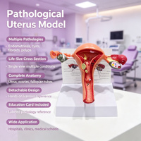Modèle pathologique de maladie utérine grandeur nature en PVC avec endométriose et fibromes pour l'enseignement médical CE ISO ROHS CNAS