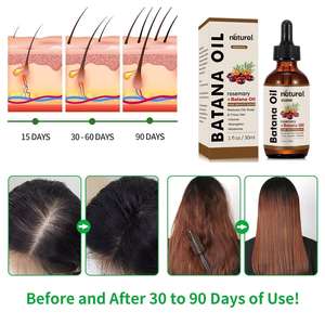 <span class=keywords><strong>Aceite</strong></span> de Batana Orgánico Natural y Tratamiento para la Caída del Cabello con Romero, Sérum para el Crecimiento del Cabello Totalmente Natural, <span class=keywords><strong>Aceite</strong></span> de Batana Crudo para el Recrecimiento del Cabello - Product Image 4