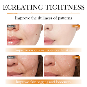 <span class=keywords><strong>Crema</strong></span> Antirughe Lisciante a Marchio Privato, Idratante Anti-Età per Linee Sottili, <span class=keywords><strong>Crema</strong></span> <span class=keywords><strong>Viso</strong></span> al Retinolo per Rimuovere le Rughe - Product Image 2