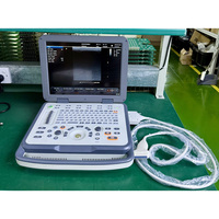 Échographe Doppler Couleur Ergonomique VS-BN60 avec Écran LCD 15 Pouces pour l'Abdomen, l'Obstétrique et la Gynécologie