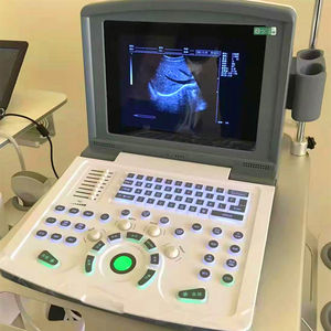 Pemindai <span class=keywords><strong>Ultrasound</strong></span> <span class=keywords><strong>Medison</strong></span>, Pemindai <span class=keywords><strong>Ultrasound</strong></span> Portabel Doppler - Product Image 5