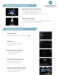 Système d'échographie diagnostique hospitalier 4D sur chariot TC16 – Échographe 4D humain/vétérinaire – Échographe médical - Product Image 4