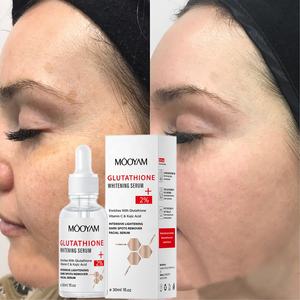 <span class=keywords><strong>เซ</strong></span><span class=keywords><strong>รั่</strong></span><span class=keywords><strong>ม</strong></span>กลูต้าไธโอน ผิวขาวใส <span class=keywords><strong>ลด</strong></span>ฝ้า กระ จุดด่างดำ ด้วยโคจิก แอซิด และวิตามินซี - Product Image 2