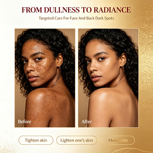 Savon de beauté artisanal biologique à étiquette privée, anti-taches brunes, nettoyant pour le visage, prévient l'hyperpigmentation, savon éclaircissant pour la peau à l'or 24 carats - Product Image 4
