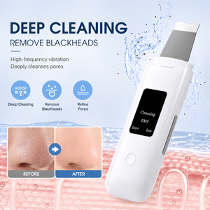 Ultrasonic Skin Scrubber Facial Cleansing <b>Blackhead</b> Pore <b>Cleaner</b> Handheld Face Nose Cleansing Ultrasonic Facial Skin Scrubber - Product Image 4