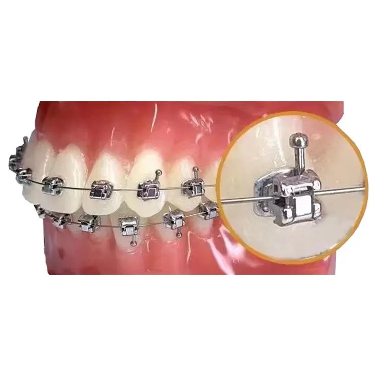 Iantian-soportes autoligantes para ortodoncia, equipos de belleza dental