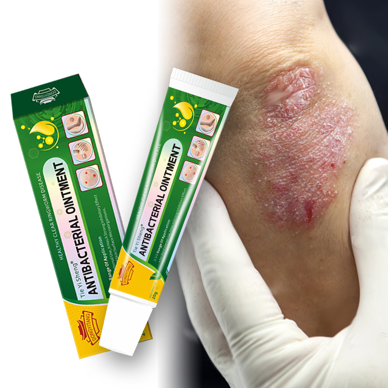 OEM/ODM Natural Herbal Eczema Ointment Wholesale Skin Itching Cream