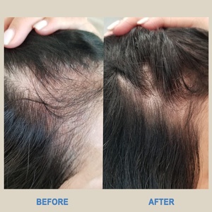 Nuevo Champú y Acondicionador con Péptidos de Cobre para Reparación del Cuero Cabelludo, Hidratación y Tratamiento de la <span class=keywords><strong>Caspa</strong></span>, Promueve el Crecimiento del Cabello - Product Image 4