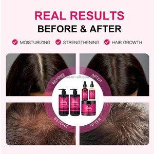 Produits capillaires <span class=keywords><strong>de</strong></span> croissance capillaire sous marque privée, biologiques, sans sulfate, prévention <span class=keywords><strong>de</strong></span> la chute des <span class=keywords><strong>cheveux</strong></span>, ensemble shampoing et après-shampoing à l'huile d'oignon et <span class=keywords><strong>de</strong></span> romarin - Product Image 3