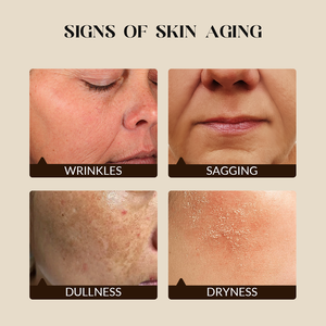 <span class=keywords><strong>Lotion</strong></span> d'acné très perméable pour femme et fille Toner hydratant efficace contrôle de l'huile équilibre acide-base - Product Image 2