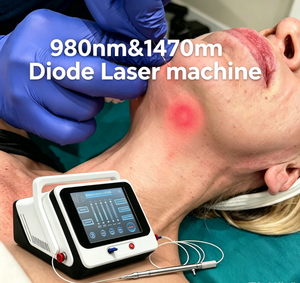 Sistema Láser de Diodo de Doble Longitud de Onda 980nm, Antienvejecimiento, Lipólisis, Eliminación <span class=keywords><strong>Vascular</strong></span>, Tratamiento de <span class=keywords><strong>Ojeras</strong></span> y Acné, Láser Portátil - Product Image 1