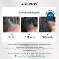 Sérum capillaire naturel végétalien blanc et noir pour le cuir chevelu, traitement non colorant pour assombrir les cheveux, Palmitoyl Tetrapeptide-20, réactivateur de pigment MC1-R
