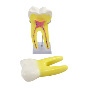 Modelo anatómico de diente molar, modelo de práctica Dental, modelos educativos de odontología, dientes de entrenamiento de biología médica - Product Image 3
