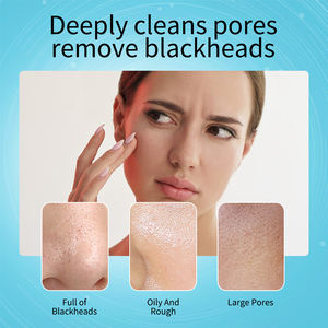 Removedor <span class=keywords><strong>de</strong></span> espinillas <span class=keywords><strong>de</strong></span> mango, <span class=keywords><strong>tratamiento</strong></span> <span class=keywords><strong>para</strong></span> el acné, Control <span class=keywords><strong>de</strong></span> aceite <span class=keywords><strong>de</strong></span> nariz, tira <span class=keywords><strong>de</strong></span> poros <span class=keywords><strong>de</strong></span> barro, crema blanqueadora, máscara exfoliante, exfoliación <span class=keywords><strong>de</strong></span> nariz, cuidado <span class=keywords><strong>de</strong></span> la <span class=keywords><strong>piel</strong></span> - Product Image 3