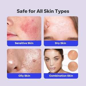 Tratamiento para el Acné Corporal, Spray Exfoliante con Ácido Salicílico para el Acné de Espalda, Puntos Negros, Imperfecciones en la Espalda y el Pecho - Product Image 4