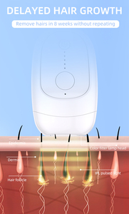 Vente Flash : <span class=keywords><strong>Appareil</strong></span> d'épilation IPL portable 510K, technologie OEM LOGO, idéal pour usage domestique, version améliorée - Product Image 6
