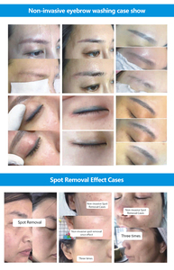 Appareil professionnel de suppression de tatouages pour salon de beauté 5-en-1 Picoseconde, équipement de nettoyage des pigments, des taches de rousseur et des sourcils, peeling au carbone - Product Image 5