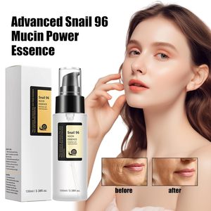 Crème <span class=keywords><strong>d</strong></span>'<span class=keywords><strong>escargot</strong></span> biologique Sérum Acide hyaluronique Centella Asiatica Extrait pour réparer les cernes Éclat Blanchissant-96 Puissance <span class=keywords><strong>de</strong></span> la mucine - Product Image 1