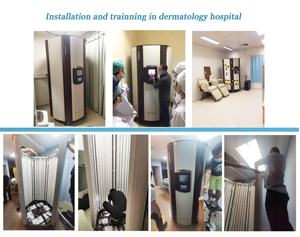 Thérapie par lumière UVB à bande étroite 311 nm, cabine de photothérapie UV pour le corps entier, pour le vitiligo, le psoriasis, l'eczéma - Product Image 4