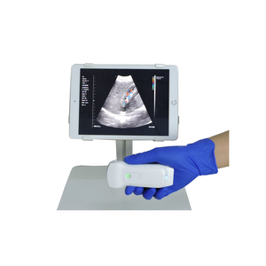 Vétérinaire sans fil Portable USB & Wifi 3-en-1 Échographie <span class=keywords><strong>Doppler</strong></span> couleur Sonde convexe et linéaire pour animal - Product Image 5